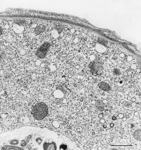 CIL:36273, Vorticella convallaria, cell by organism, eukaryotic cell, Eukaryotic Protist, Ciliated Protist