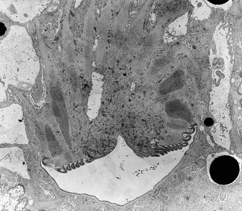 CIL:39137, Nassula, cell by organism, eukaryotic cell, Eukaryotic Protist, Ciliated Protist