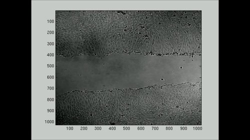 CIL:43418, Mus musculus, mammary adenocarcinoma