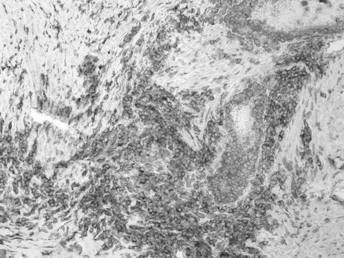 CIL:32385, Homo sapiens, endocrine-paracrine cell of prostate gland, basal cell of prostate epithelium, luminal cell of prostate epithelium, blood vessel endothelial cell, perineural cell, sheath cell, leukocyte, prostate stromal cell, smooth muscle cell of prostate