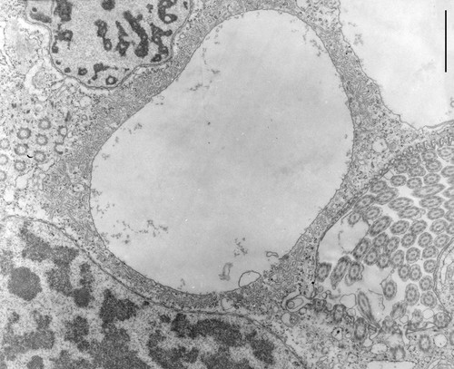 CIL:9910, Opercularia [NCBITaxon:168247], Opercularia coarctata, cell by organism, eukaryotic cell, Eukaryotic Protist, Ciliated Protist