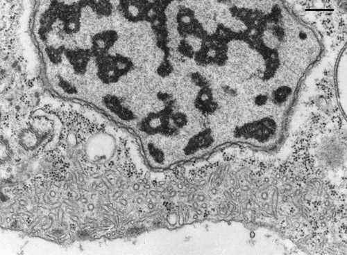 CIL:9911, Opercularia [NCBITaxon:168247], Opercularia coarctata, cell by organism, eukaryotic cell, Eukaryotic Protist, Ciliated Protist