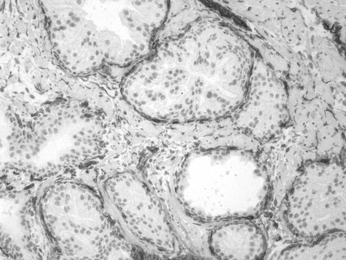 CIL:34125, Homo sapiens, endocrine-paracrine cell of prostate gland, basal cell of prostate epithelium, luminal cell of prostate epithelium, blood vessel endothelial cell, perineural cell, sheath cell, leukocyte, prostate stromal cell, smooth muscle cell of prostate