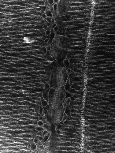 CIL:36130, damselfly, flight muscle cell