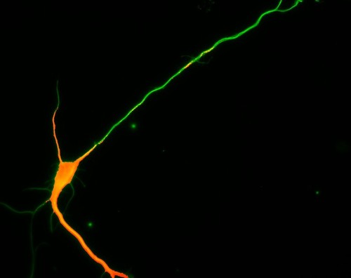 CIL:8276, Rattus, multipolar neuron