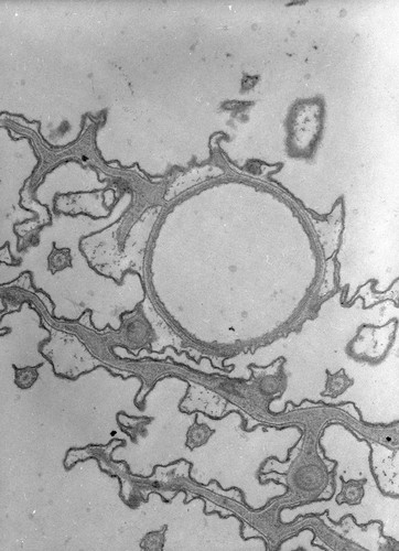 CIL:38894, Paramecium caudatum, cell by organism, eukaryotic cell, Eukaryotic Protist, Ciliated Protist