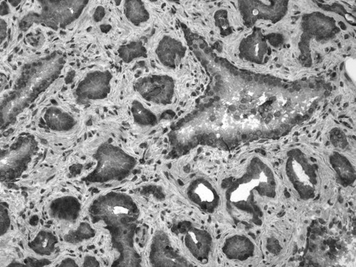 CIL:33670, Homo sapiens, endocrine-paracrine cell of prostate gland, basal cell of prostate epithelium, luminal cell of prostate epithelium, blood vessel endothelial cell, perineural cell, sheath cell, leukocyte, prostate stromal cell, smooth muscle cell of prostate