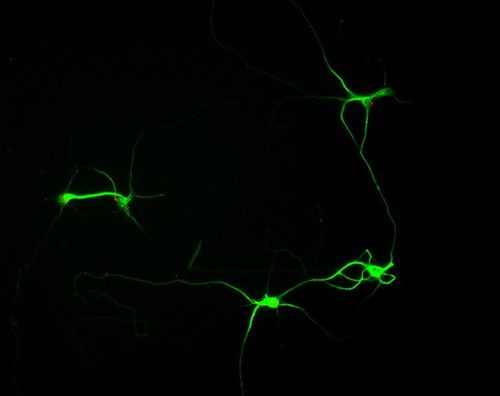 CIL:6162, Rattus, multipolar neuron