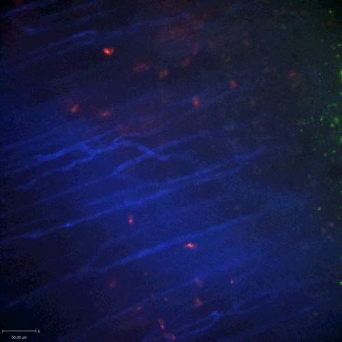 CIL:47540, Staphylococcus aureus, neutrophil, endothelial cell