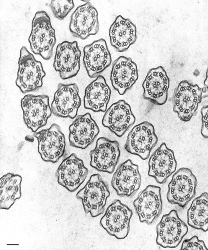 CIL:34611, Tetrahymena pyriformis, cell by organism, eukaryotic cell, Eukaryotic Protist, Ciliated Protist