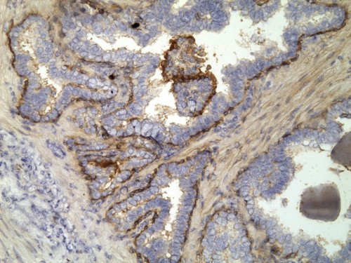 CIL:32182, Homo sapiens, endocrine-paracrine cell of prostate gland, basal cell of prostate epithelium, luminal cell of prostate epithelium, blood vessel endothelial cell, perineural cell, sheath cell, leukocyte, prostate stromal cell, smooth muscle cell of prostate