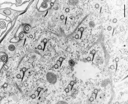 CIL:13154, Paramecium multimicronucleatum, cell by organism, eukaryotic cell, Eukaryotic Protist, Ciliated Protist