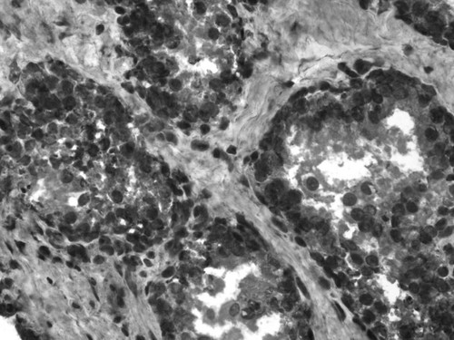 CIL:33662, Homo sapiens, endocrine-paracrine cell of prostate gland, basal cell of prostate epithelium, luminal cell of prostate epithelium, blood vessel endothelial cell, perineural cell, sheath cell, leukocyte, prostate stromal cell, smooth muscle cell of prostate