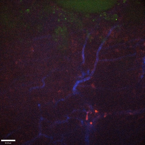 CIL:47590, Staphylococcus aureus, neutrophil, endothelial cell