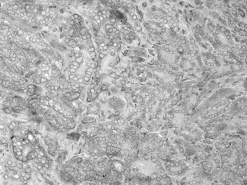 CIL:33607, Homo sapiens, endocrine-paracrine cell of prostate gland, basal cell of prostate epithelium, luminal cell of prostate epithelium, blood vessel endothelial cell, perineural cell, sheath cell, leukocyte, prostate stromal cell, smooth muscle cell of prostate