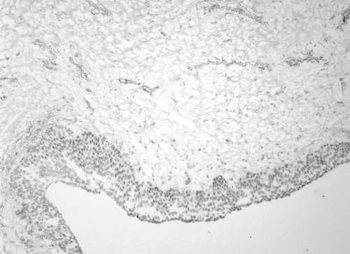 CIL:34102, Homo sapiens, endocrine-paracrine cell of prostate gland, basal cell of prostate epithelium, luminal cell of prostate epithelium, blood vessel endothelial cell, perineural cell, sheath cell, leukocyte, prostate stromal cell, smooth muscle cell of prostate