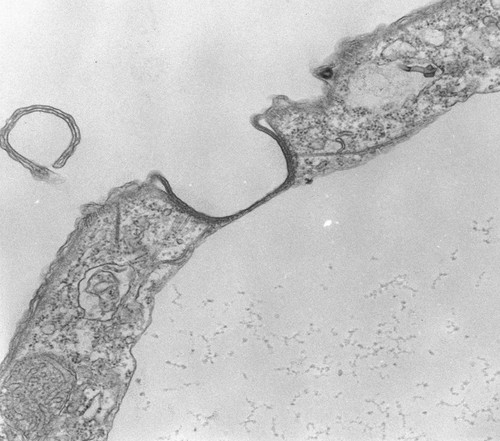 CIL:39793, Tetrahymena pyriformis, cell by organism, eukaryotic cell, Eukaryotic Protist, Ciliated Protist