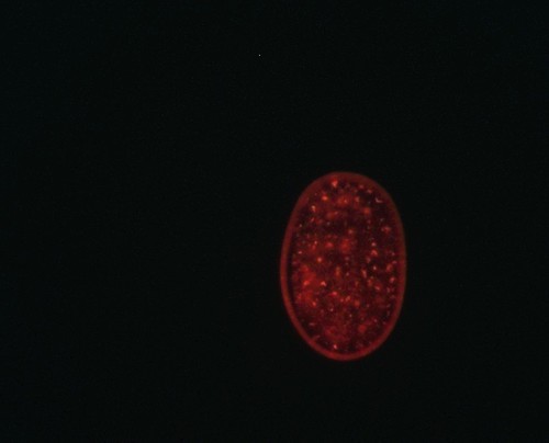 CIL:13905, Caenorhabditis elegans, embryo