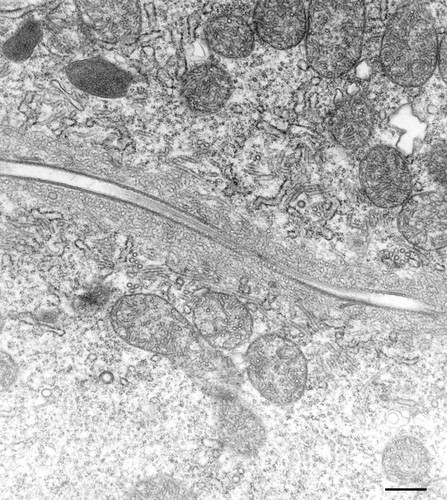 CIL:13110, Paramecium multimicronucleatum, cell by organism, eukaryotic cell, Eukaryotic Protist, Ciliated Protist