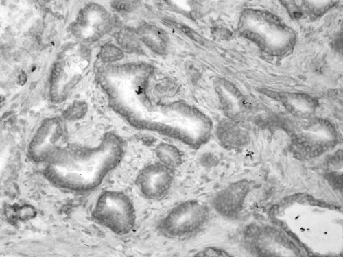 CIL:34012, Homo sapiens, endocrine-paracrine cell of prostate gland, basal cell of prostate epithelium, luminal cell of prostate epithelium, blood vessel endothelial cell, perineural cell, sheath cell, leukocyte, prostate stromal cell, smooth muscle cell of prostate