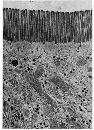 CIL:11106, Rattus, ciliated epithelial cell