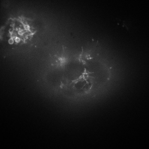 CIL:9097, Homo sapiens, epithelial cell, permanent cell line cell