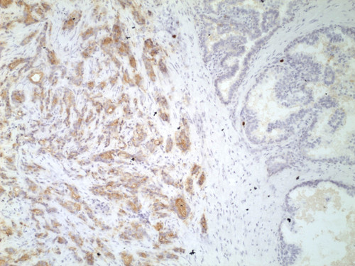 CIL:33501, Homo sapiens, endocrine-paracrine cell of prostate gland, basal cell of prostate epithelium, luminal cell of prostate epithelium, blood vessel endothelial cell, perineural cell, sheath cell, leukocyte, prostate stromal cell, smooth muscle cell of prostate