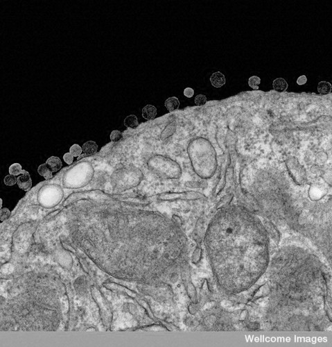 CIL:39465, lymphocyte, human immunodeficiency virus