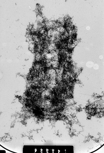 CIL:35375, Homo sapiens, cevical carcinoma