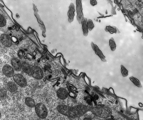 CIL:12615, Paramecium multimicronucleatum, cell by organism, eukaryotic cell, Eukaryotic Protist, Ciliated Protist