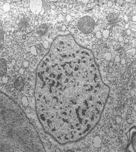 CIL:39452, Vorticella convallaria, cell by organism, eukaryotic cell, Eukaryotic Protist, Ciliated Protist