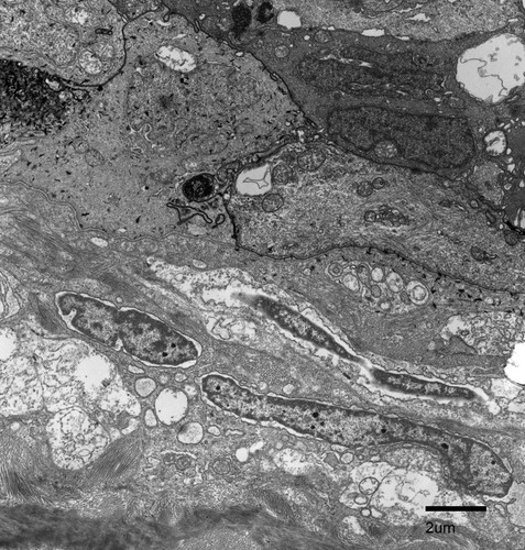 CIL:27227, Fundulus heteroclitus, epidermal cell, fibroblast