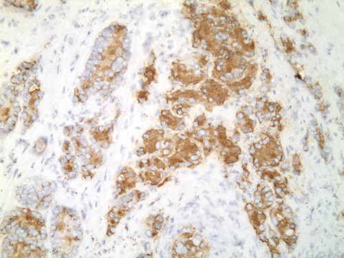 CIL:33486, Homo sapiens, endocrine-paracrine cell of prostate gland, basal cell of prostate epithelium, luminal cell of prostate epithelium, blood vessel endothelial cell, perineural cell, sheath cell, leukocyte, prostate stromal cell, smooth muscle cell of prostate