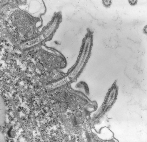 CIL:39241, uncultured scuticociliate, Conchophthirus curtus, cell by organism, eukaryotic cell, Eukaryotic Protist, Ciliated Protist