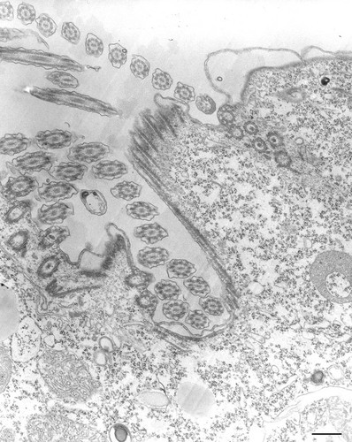 CIL:35484, Tetrahymena pyriformis, cell by organism, eukaryotic cell, Eukaryotic Protist, Ciliated Protist