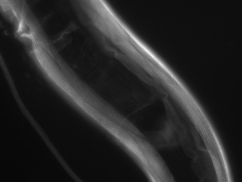 CIL:1059, Caenorhabditis elegans, muscle cell