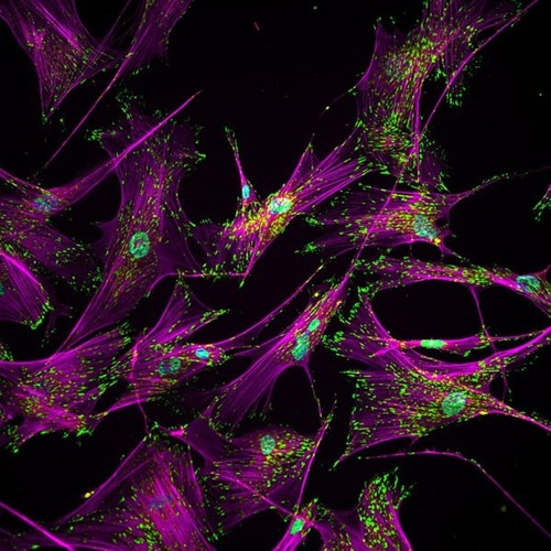 CIL:44701, Homo sapiens, fibroblast of lung