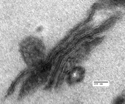 CIL:40420, Saccharomyces cerevisiae, arf1∆ mutant