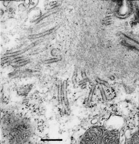 CIL:9815, Opercularia [NCBITaxon:168247], Opercularia coarctata, cell by organism, eukaryotic cell, Eukaryotic Protist, Ciliated Protist