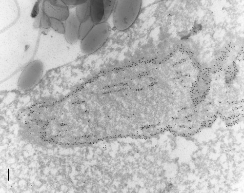 CIL:12090, Paramecium tetraurelia, cell by organism, eukaryotic cell, Eukaryotic Protist, Ciliated Protist