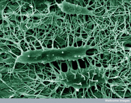 CIL:39056, Mus musculus, osteocyte