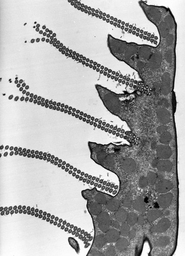 CIL:38891, Euplotes sp., cell by organism, eukaryotic cell, Eukaryotic Protist, Ciliated Protist