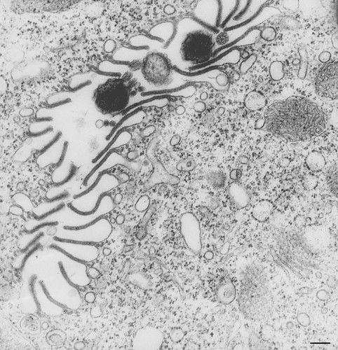 CIL:36269, Vorticella convallaria, cell by organism, eukaryotic cell, Eukaryotic Protist, Ciliated Protist