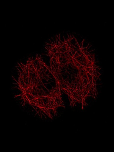 CIL:36132, Drosophila melanogaster, epithelial cell