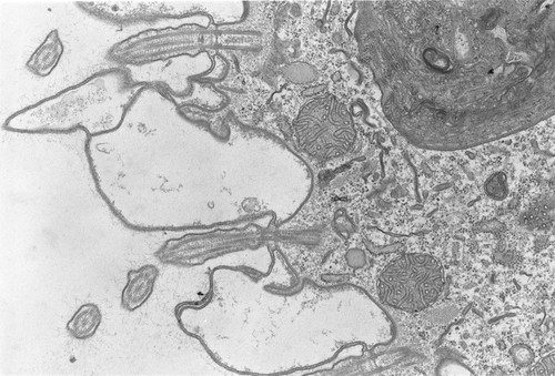 CIL:2870, Coleps hirtus, eukaryotic cell, Eukaryotic Protist, Ciliated Protist