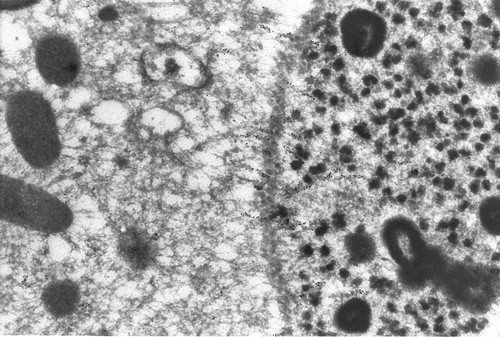 CIL:1313, Paramecium tetraurelia, cell by organism, eukaryotic cell, Eukaryotic Protist, Ciliated Protist