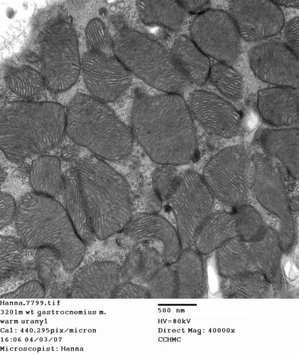 CIL:348, Mus musculus, skeletal muscle cell