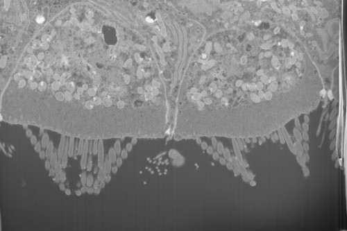 CIL:50680, FIB-SEM Dataset of anti-PKHD1L1 Immuno-Gold Labeled Outer Hair Cell Stereocilia Bundles