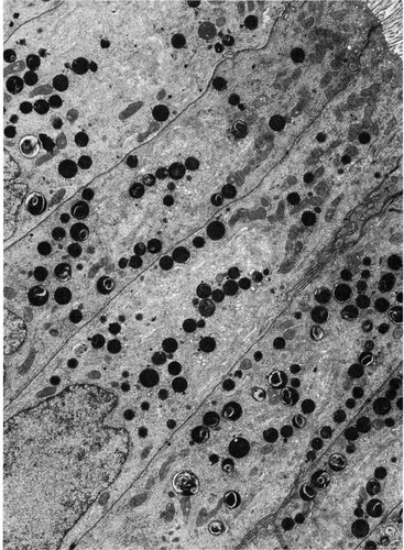 CIL:10845, Leporidae, columnar/cuboidal epithelial cell