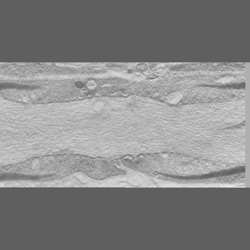 CIL:40165, Mus musculus, peripheral neuron, myelinating Schwann cell